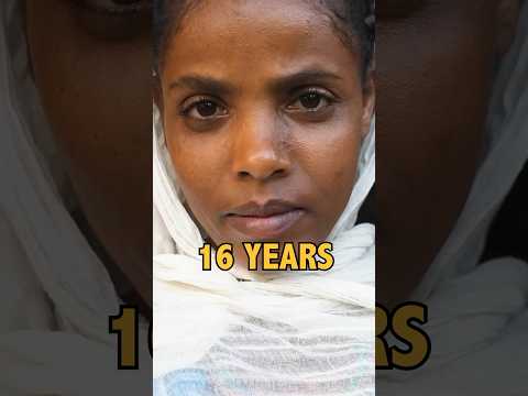 This Woman Hasn’t Eaten in 16 Years (No Food or Water)